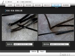 step2-2